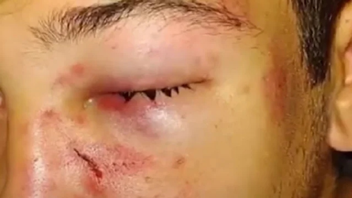 ...